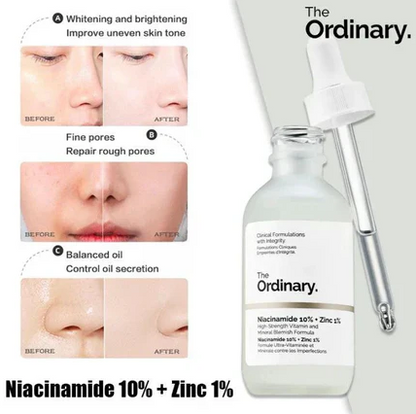 The Ordinary Niacinamide 10% + Zinc 1 % - 30ml |Oil Control, Pore Minimizing & Blemish Solution Serum