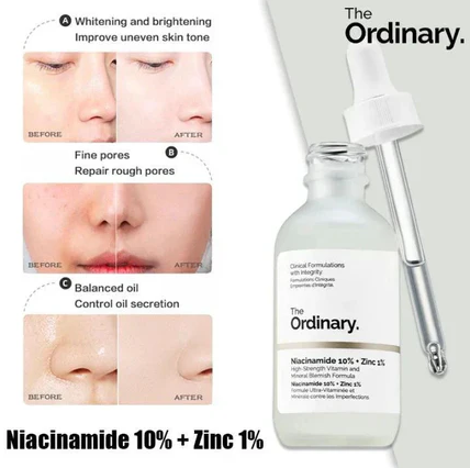The Ordinary Niacinamide 10% + Zinc 1 % - 30ml |Oil Control, Pore Minimizing & Blemish Solution Serum