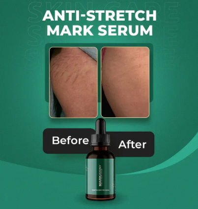MarkAway Herbal Stretch Mark Serum: Hydration, Toning, Dark Spot Correction (1 fl oz)
